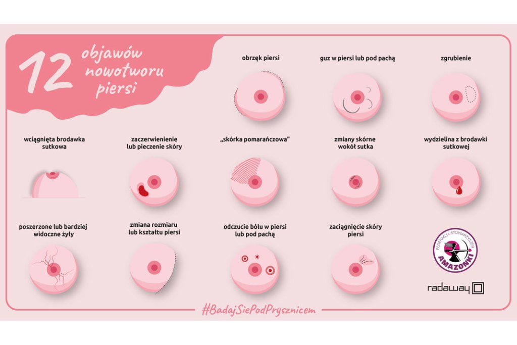 grafika pokazująca główne objawy nowotworu piersi